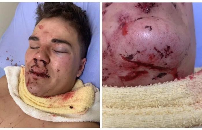 Man
      who
      killed
      attacker
      in
      Banff
      used
      'excessive'
      force,
      sentenced
      to
      2-year
      house
      arrest