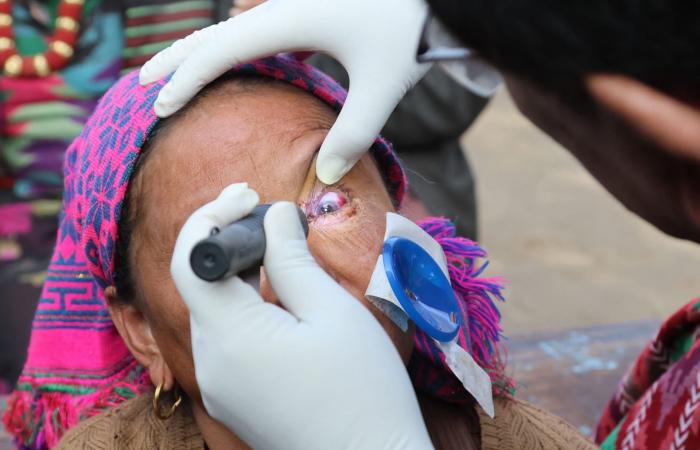 لقّب بـ"إله البصر".. ما قصة طبيب العيون النيبالي الذي عالج أكثر من 100 ألف شخص؟