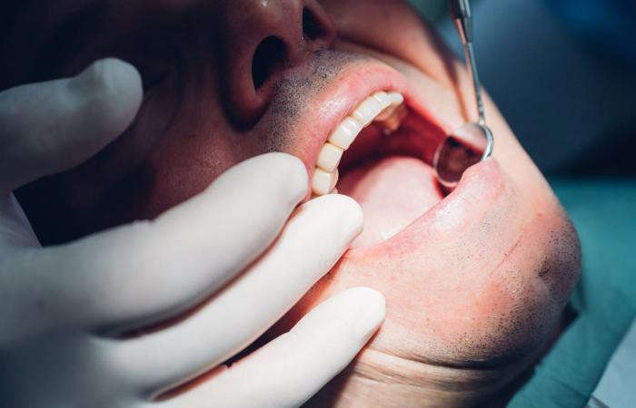 تعاطي الماريجوانا يشوّه ابتسامتك.. طبيبة أسنان توضّح الأسباب