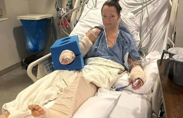 بعد
      هجوم
      من
      كلبها
      داخل
      منزلها..
      أم
      أمريكية
      تفقد
      ساقها
      بقرار
      طبي
      صعب