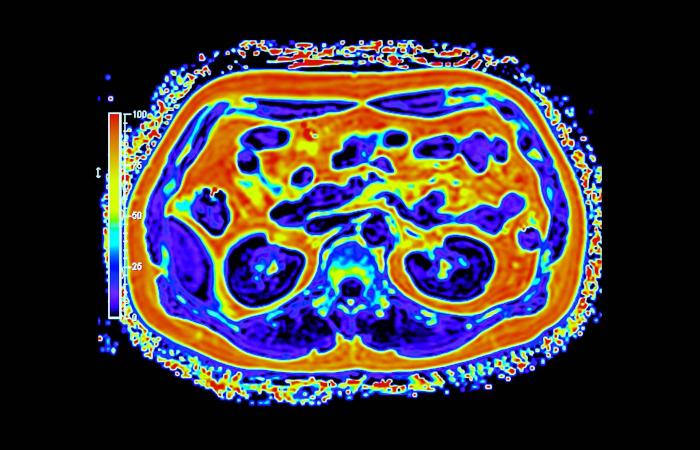 «غوغل»
      تطلق
      ميزة
      جديدة
      لتنظيم
      الاشتراكات
      البريدية
      في
      «جيميل»