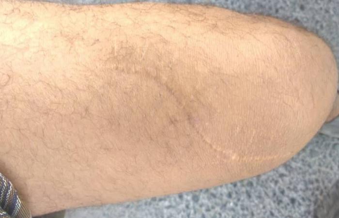 «الشرق
      الأوسط»
      تكشف
      تفاصيل
      ممارسات
      القوات
      الإماراتية
      بحق
      سجناء
      مطار
      الريان