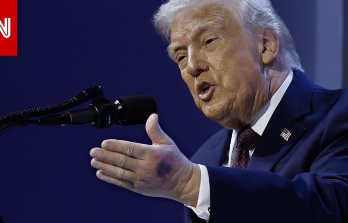 متابعة: "لقد خدشتها".. ترامب يقدم "تفسيراً" لـCNN بشأن كدمة يده الكبيرة