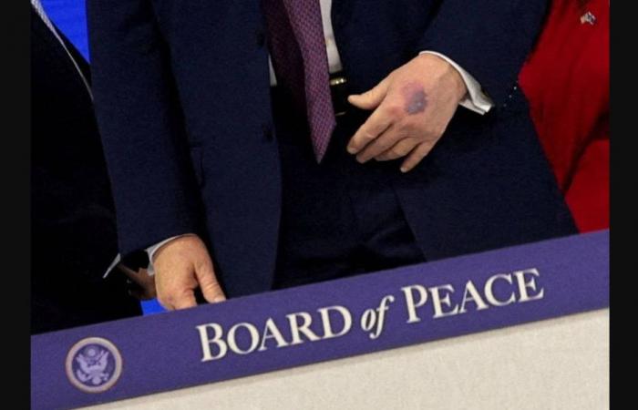 تقرير:
      ترمب
      توقّف
      عن
      صبغ
      شعره
      ويتوقع
      أنه
      سيموت
      خلال
      10
      سنوات