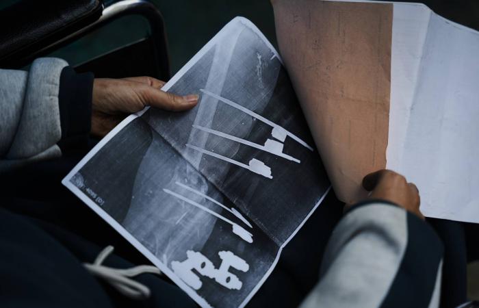 آمال
      جرحى
      غزة
      تنعقد
      على
      فتح
      معبر
      رفح
      غداً