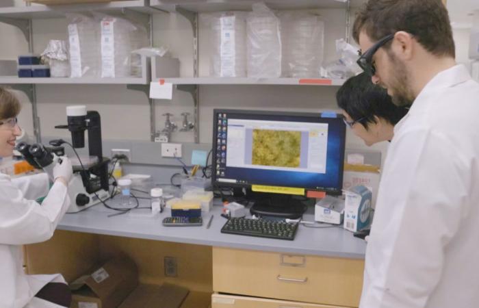 الأنف يلعب دورًا مهمًا في شدة الزكام بين شخص وآخر