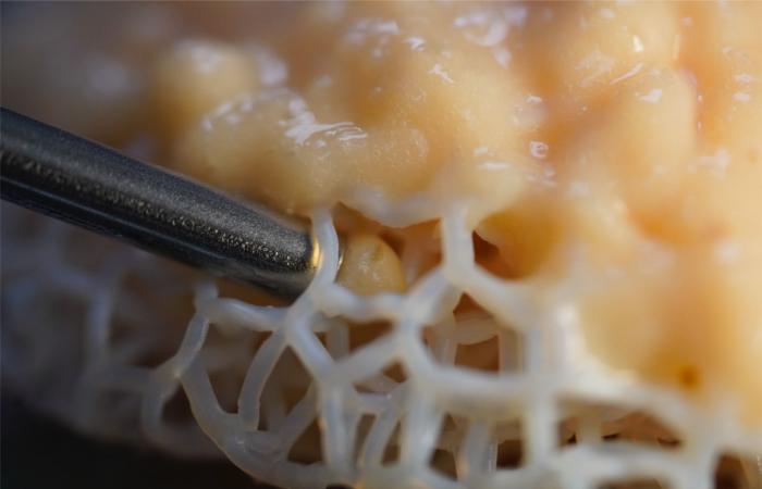 ابتكار أنسجة للثدي ثلاثية البعد لدعم الناجيات من مرض السرطان