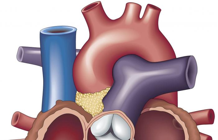 عندما
      تعمل
      الجينات
      معاً:
      تفسير
      جديد
      لأمراض
      القلب
      الوراثية