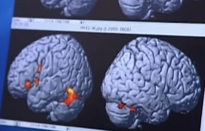 تدريب الدماغ على السرعة قد يُقلّل من خطر الإصابة بمرض الزهايمر وأنواع خرف أخرى.. كيف؟