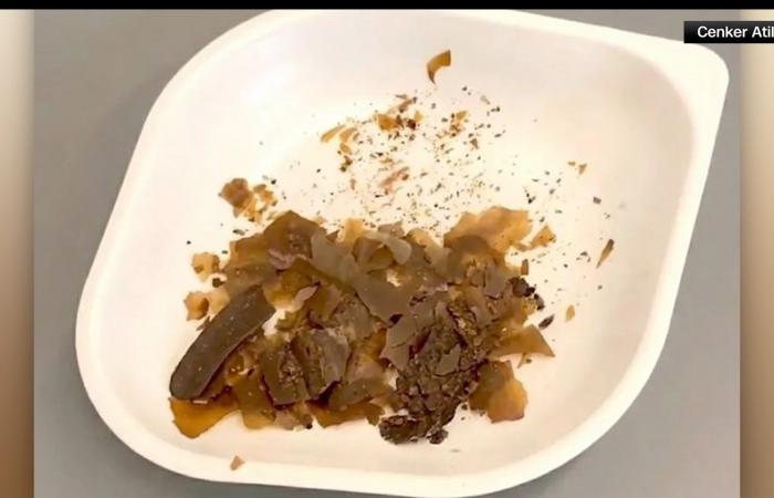 الرومان القدماء استخدموا البراز لعلاج مشاكل طبية.. فهل كانوا على حق؟