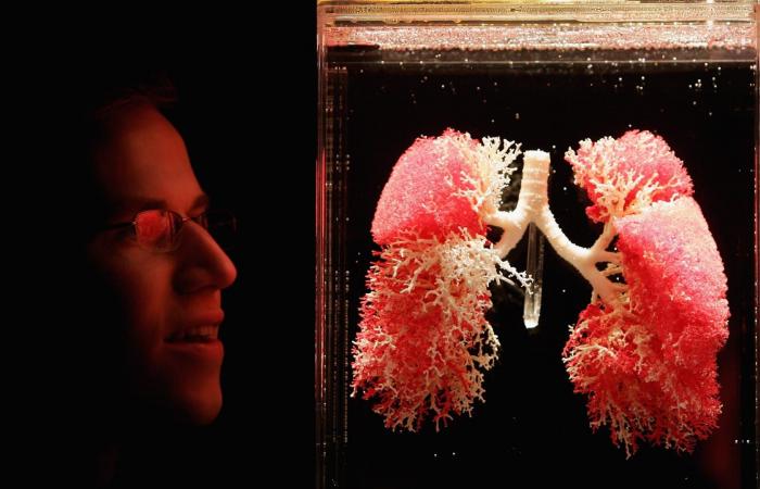 أعراض الجلطة الرئوية..هذه فئة الأشخاص الأكثر عرضة للإصابة بها