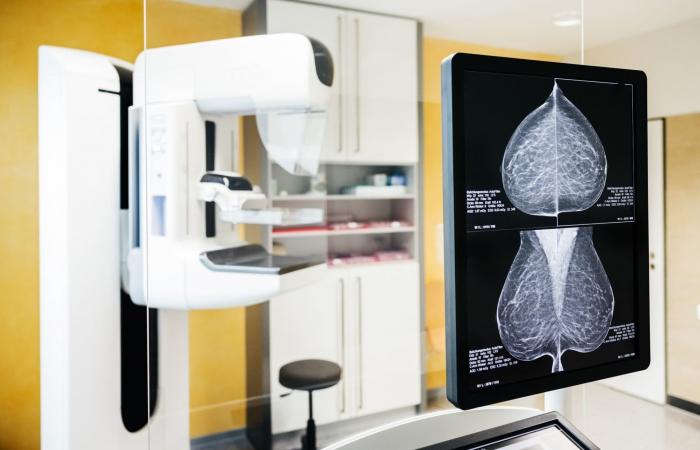 بحلول عام 2050.. تشخيص سرطان الثدي سيفوق 3.5 ملايين حالة عالميًا