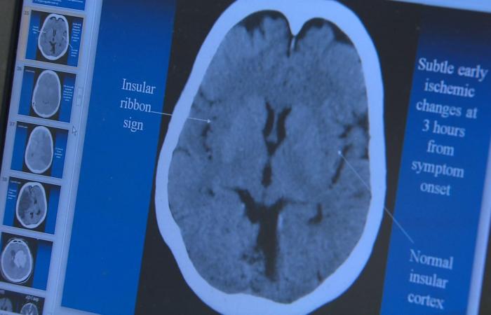 التعب والهبّات الساخنة وتغيّرات المزاج.. كيف نميّز بين أعراض سنّ اليأس والتصلّب المتعدّد؟