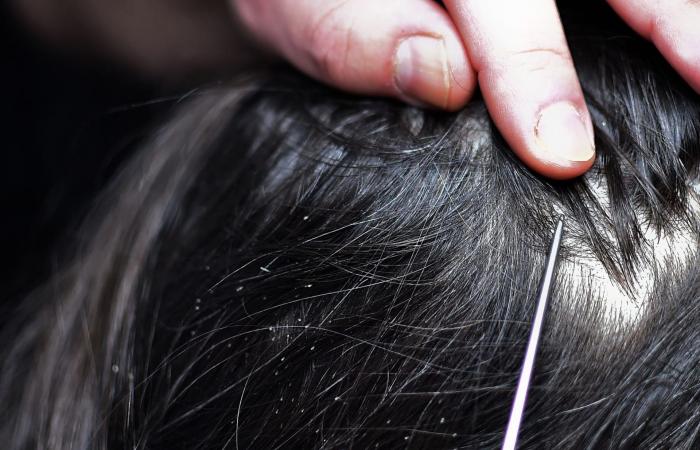 لدغ البعوض للبشر..متى بدأ وفي أي منطقة؟