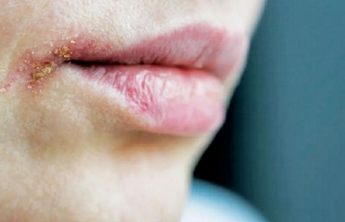 أطباء مختصون لـ "الشرق": مخاطر صحية لا تراها العين تختبئ خلف بريق المكياج