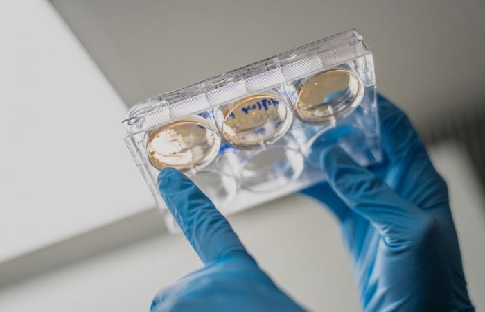 لقاحات الحمض النووي الريبوزي المرسال.. أمل جديد في مواجهة السرطان